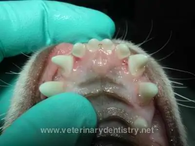 Dental Malocclusion 