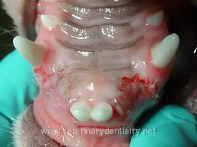 Dental Malocclusion