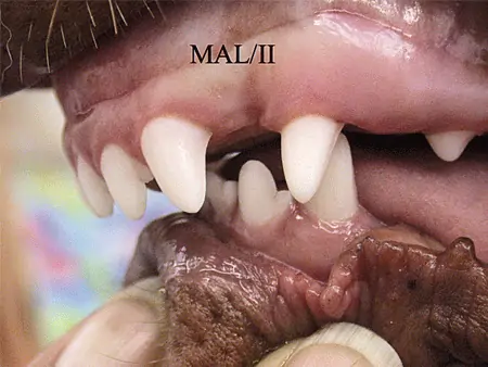 Dental Malocclusion Photo 5<br />
